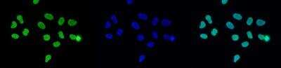 Immunocytochemistry/ Immunofluorescence: Histone H3 [Trimethyl Lys27] Antibody [NBP2-54614]